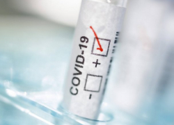 В Кишиневе растет число случаев заражения коронавирусом 