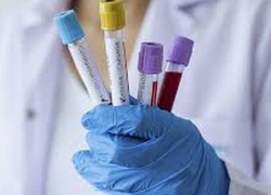 В Молдове выявили 2394 новых случая COVID-19 – слишком много для выходных