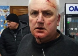 В Бричанском районе примар избил советника из-за штампов ДПМ