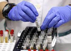 В Молдове выявлено 512 новых случаев COVID-19  