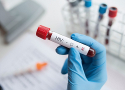 В Молдове проживает более 16 тысяч больных ВИЧ/СПИД