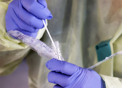 В Молдове выявлено 730 новых случаев COVID-19 