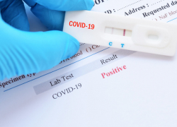 Граждане со страховыми полисами смогут пройти бесплатный тест на ковид перед госпитализацией