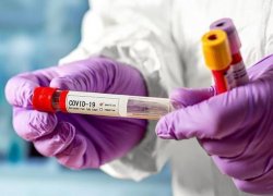 В Молдове выявлено 459 новых случаев COVID-19 