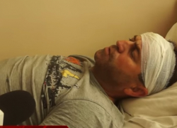 Предвыборная драка в Каушанах - кандидат в горсовет попал в больницу