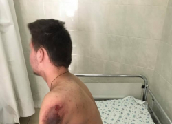 В столице автоледи сбила парня и сбежала с места происшествия, потеряв номер автомобиля