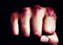 Смерть от кулаков своего сына: 66-летняя женщина скончалась после избиения