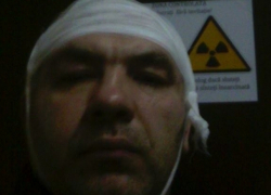 Надевший на осла полицейскую форму активист пострадал от пробравшегося в дом вора 