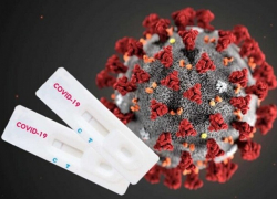 В Молдове +193 новых случая COVID-19  