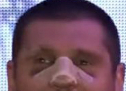 Вид Савченко с заплывшим от синяков лицом и сломанным носом шокировал украинцев 