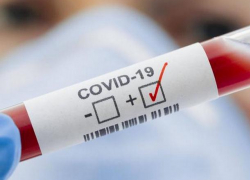 В Молдове выявлено +891 новых случаев COVID-19