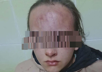 Избиение школьницы в Яловенском районе: виновным грозит реальный срок