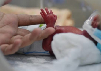 Молдавские врачи спасли ребенка с экстремально низким весом