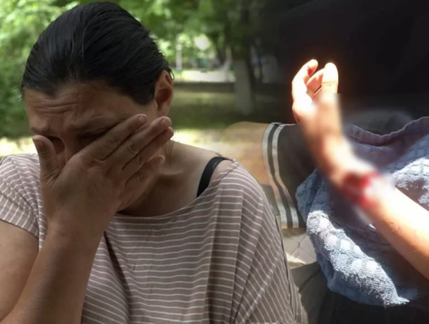 Игра в футбол могла завершиться трагедией: Собака чуть не загрызла мальчика, искусав ребенку лицо