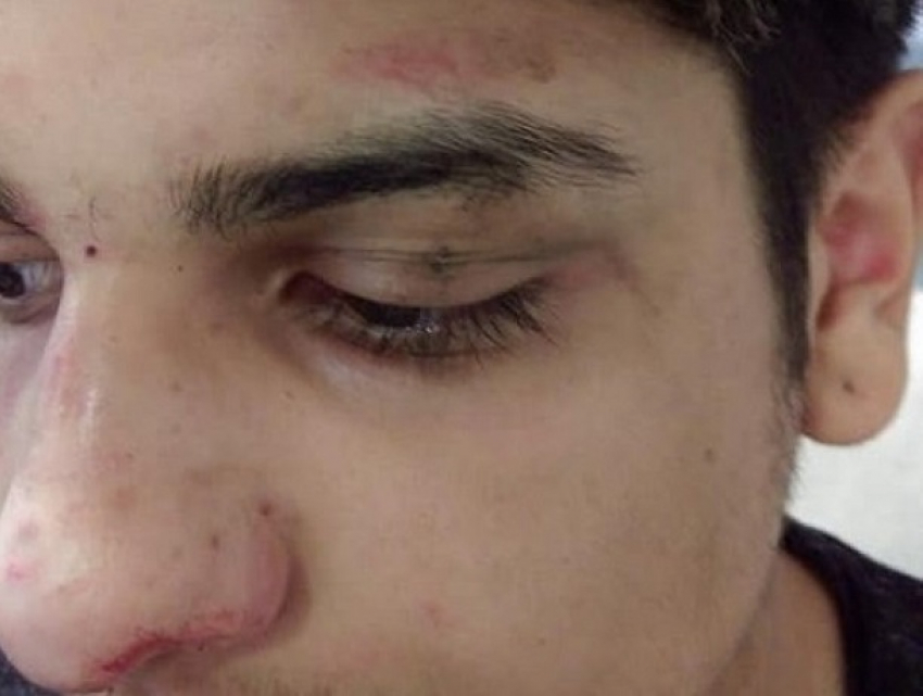 Манчестерские подростки избили смуглого школьника-мигранта из Румынии 