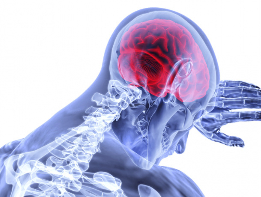 Каждый час в Молдове один человек переносит инсульт - Минздрав