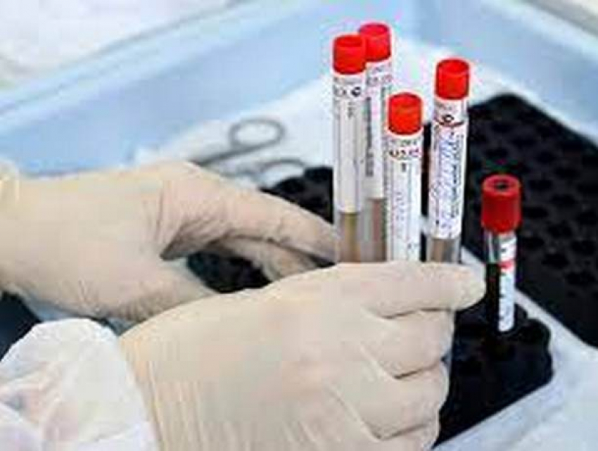 В Молдове выявлено 2057 новых случаев COVID-19   