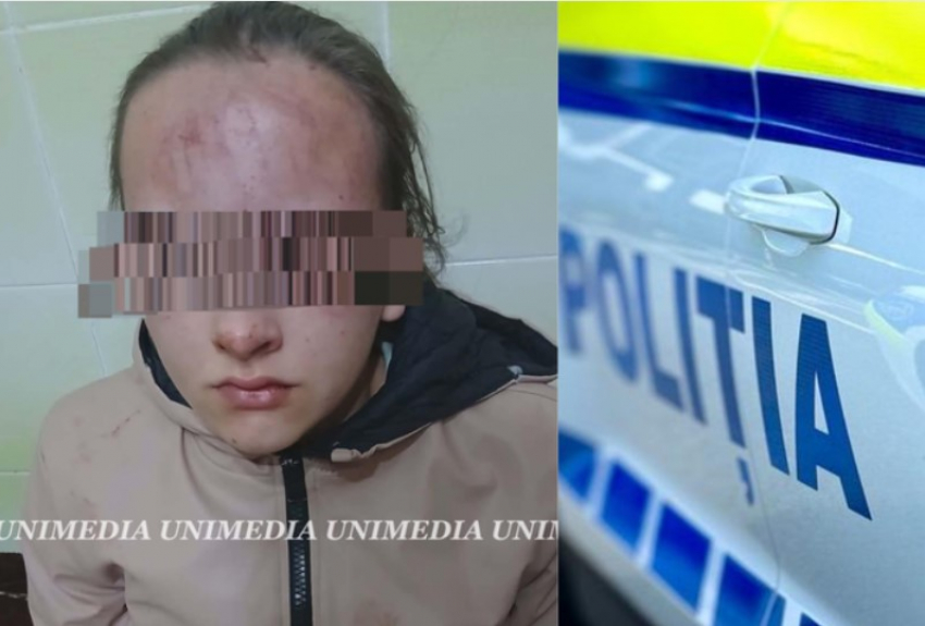 В Яловенском районе 13-летняя девочка была избита малолетками: возбуждено уголовное дело