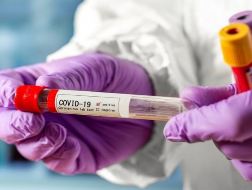 В Молдове выявлено 329 новых случаев COVID-19