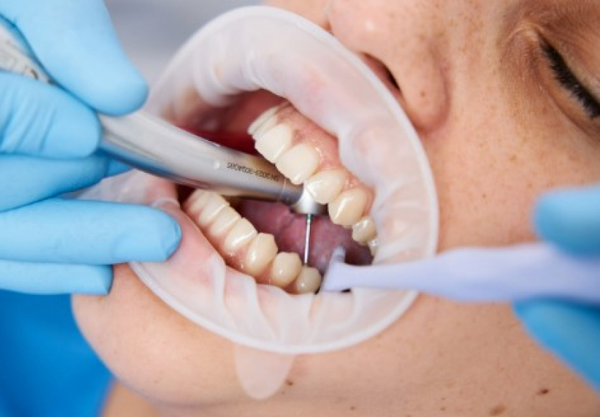 До 10 человек в год погибают в Молдове из-за нелеченных зубных инфекций