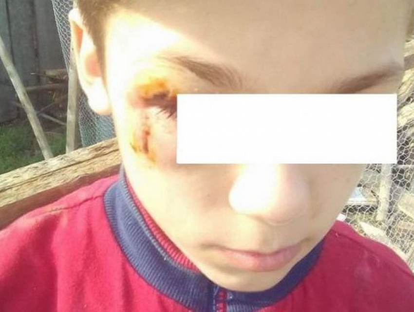 Жестокое избиение сына матерью-молдаванкой снял на видео ее сожитель-румын