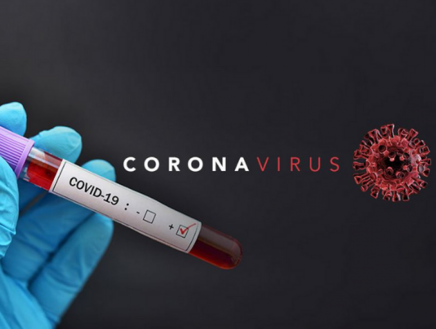 Правительство будет регулировать цены на лабораторный анализ для диагностики короанвируса