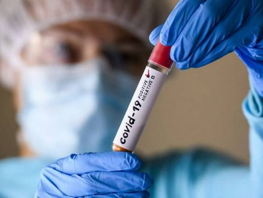 В среду в Молдове подтвердились еще 734 новых случая COVID-19 
