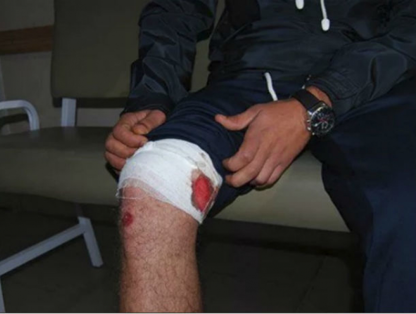 Случайным выстрелом ранил в ногу приятеля житель Каушанского района