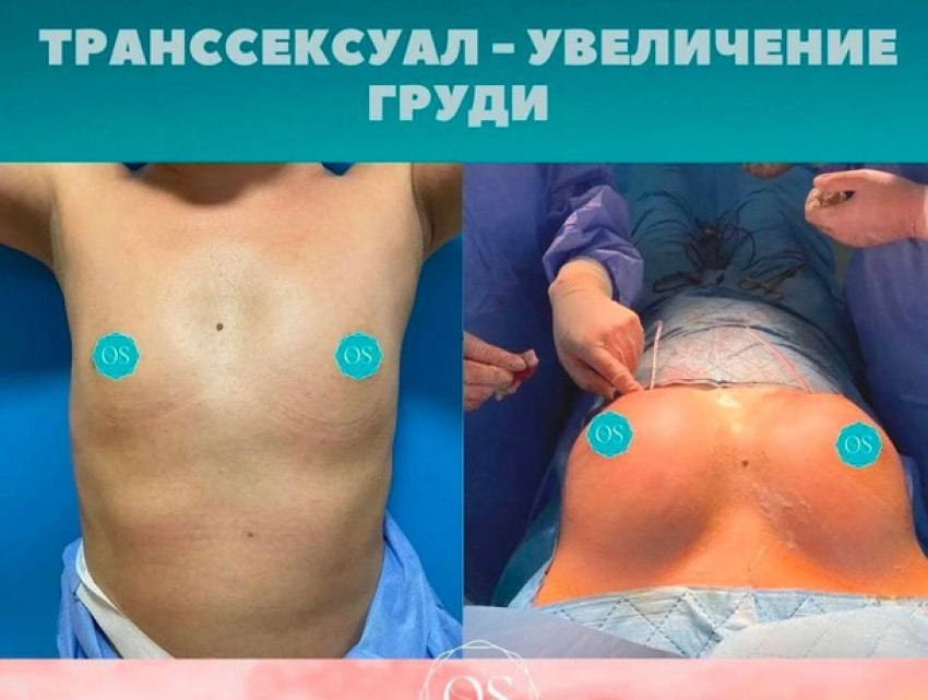 Невероятное большая грудь женщины по низкой цене - адвокаты-калуга.рф
