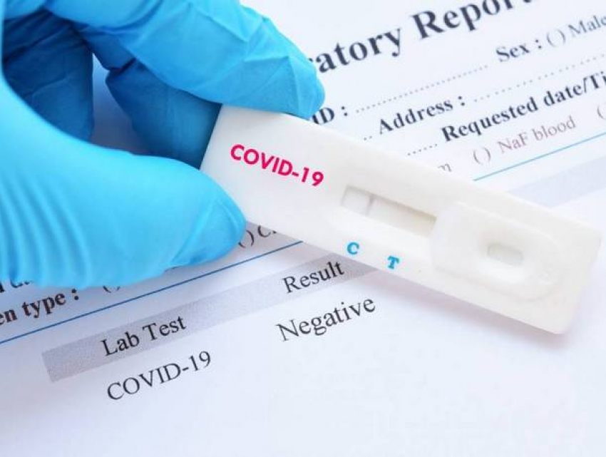Люди с симптомами коронавируса смогут сделать экспресс-тест на антиген SARS-CoV-2 бесплатно