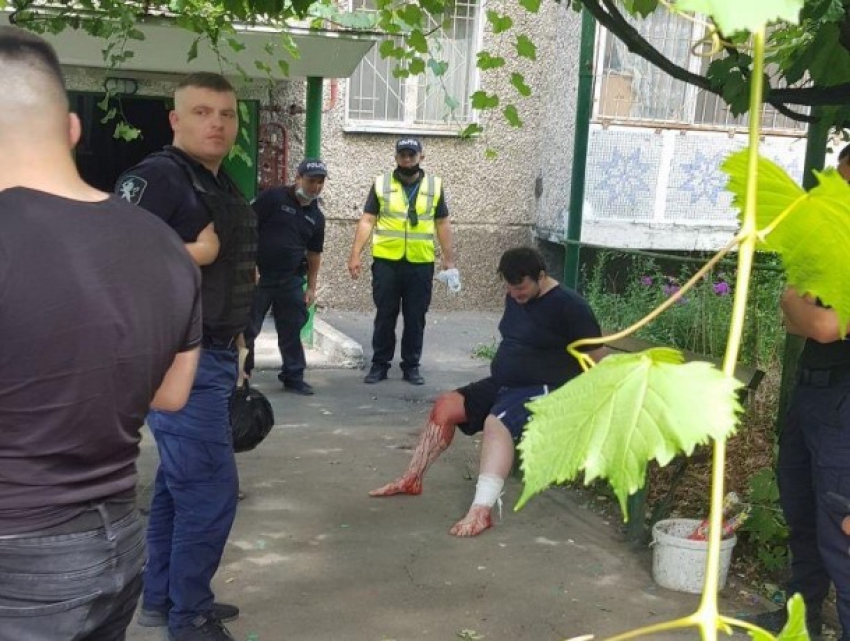В Кишиневе пьяный с ножом ранил полицейского и был наказан выстрелом в ногу