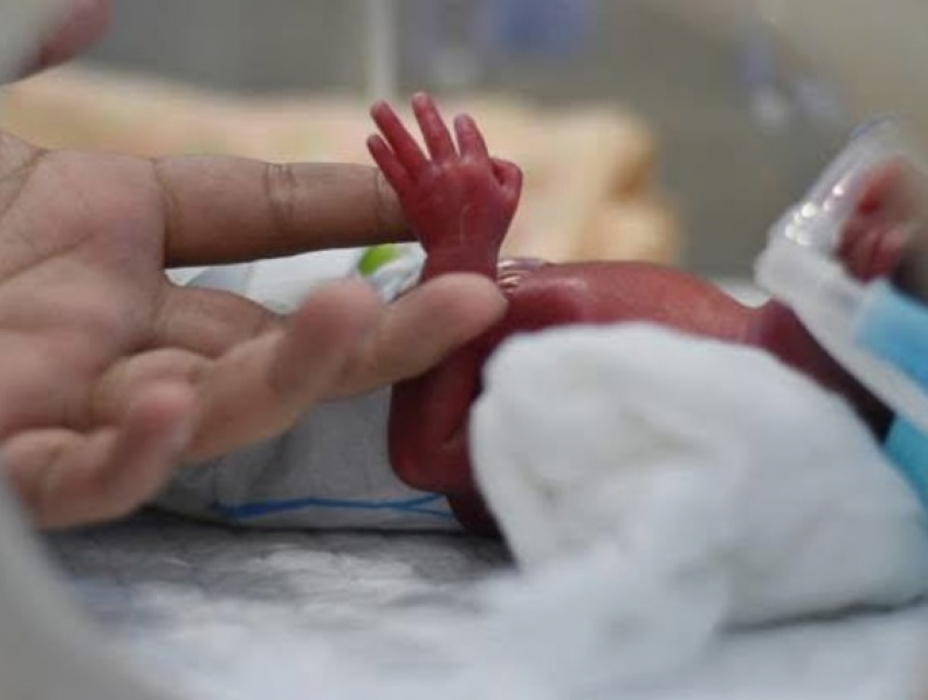 Молдавские врачи спасли ребенка с экстремально низким весом