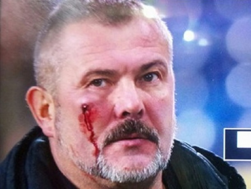 Кровавое избиение депутата-националиста на стадионе совершили футбольные фанаты