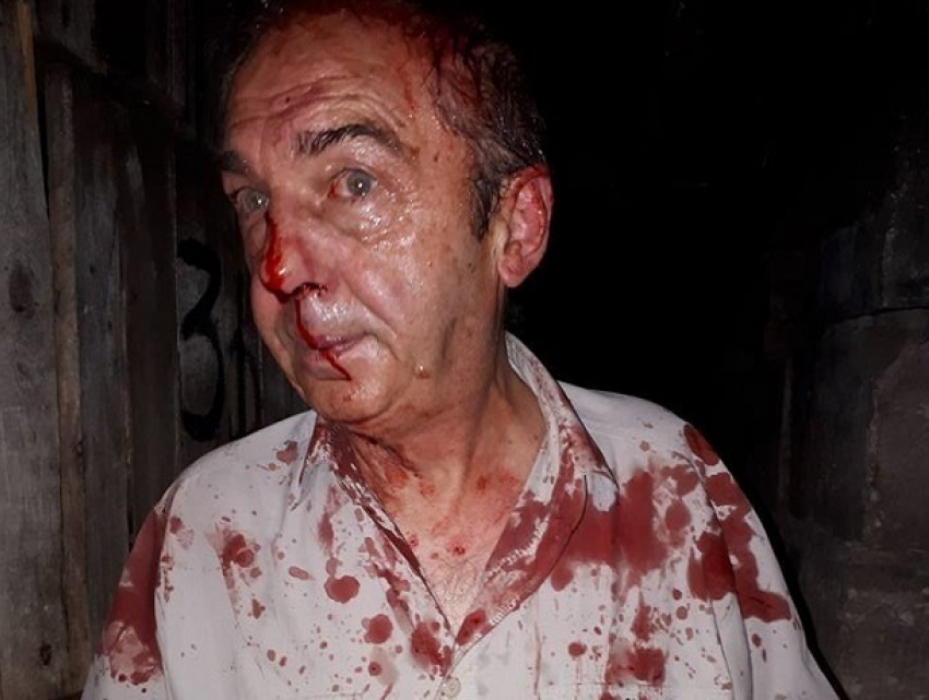 Избитого до крови председателя дома на Рышкановке сняли на видео