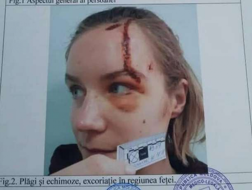 Сервис Yandex.Taxi отреагировал на историю пассажирки, пострадавшей по вине водителя