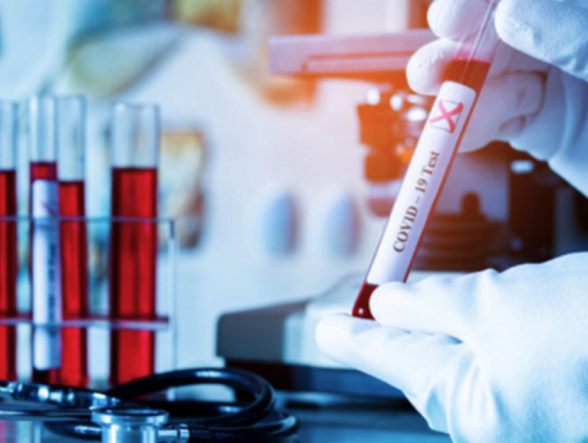 Срочно! В Молдове выявлено 530 новых случаев COVID-19