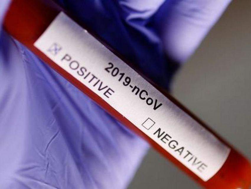 Новая смерть от коронавируса в Молдове - на этот раз в Глодянах