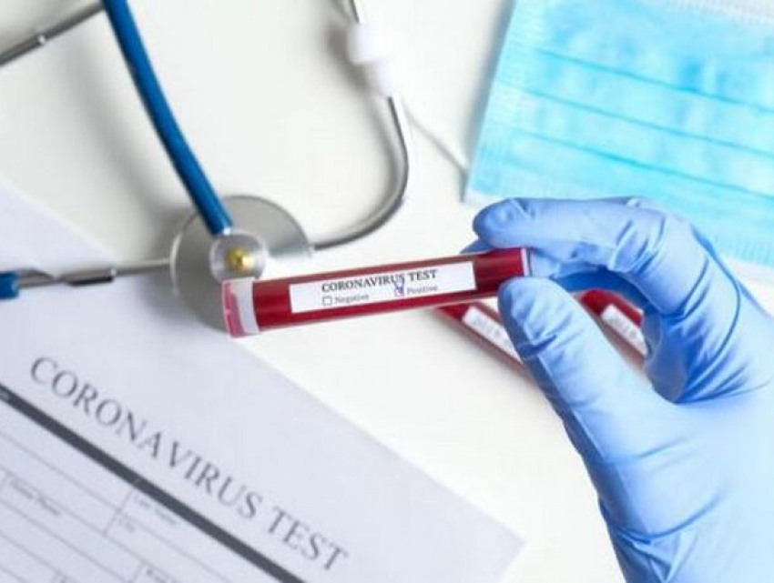 Срочно! В Молдове выявили 375 новых случаев COVID-19 