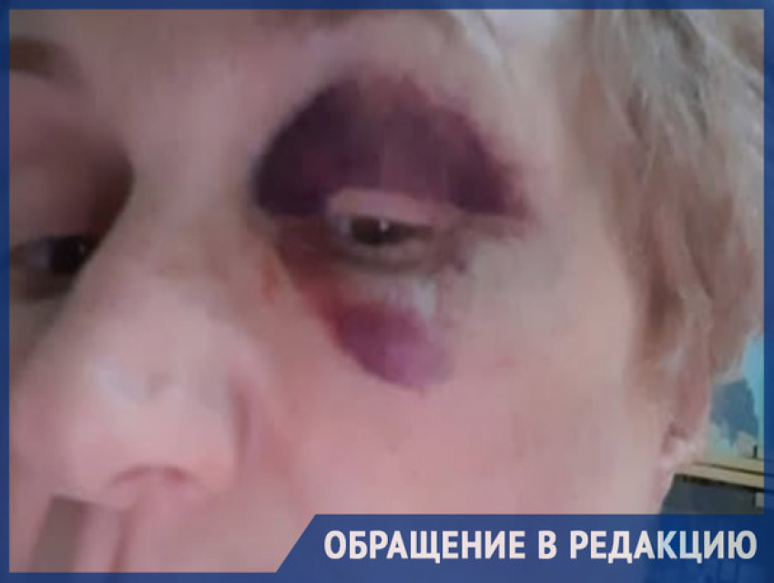 Женщину избили среди бела дня на одной из столичных улиц