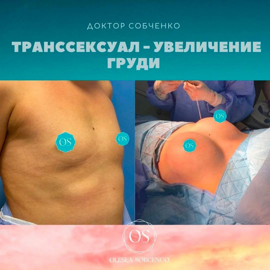 МВД объявило в розыск модель-украинку, оголившую грудь на Красной площади