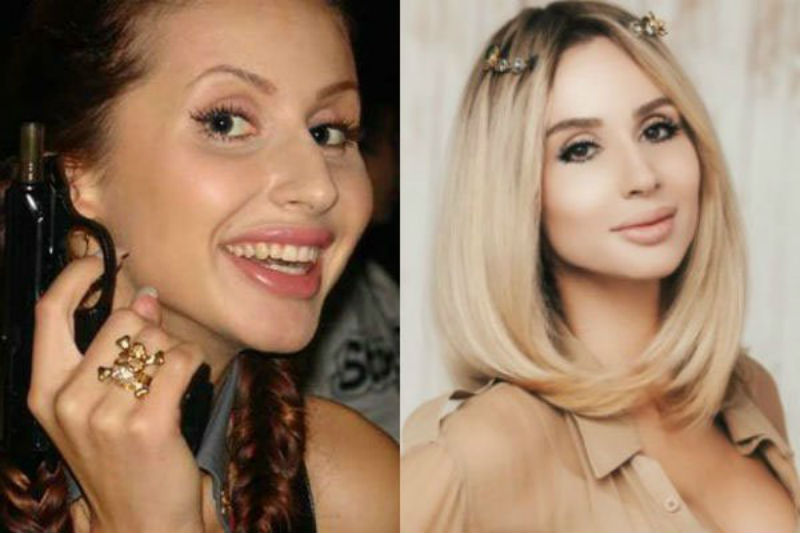 Светлана Лобода до и после пластики носа, губ и груди. Какие операции сделала певица?